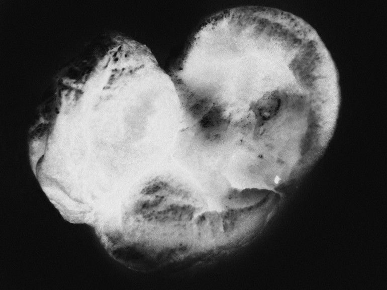 Sonogrammes_III_Yorkshire_Pudding_2000px